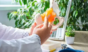 Orthopedic physician holding an anatomical hip joint model with orange femoral head in a clinical office setting with a laptop and plants in the background